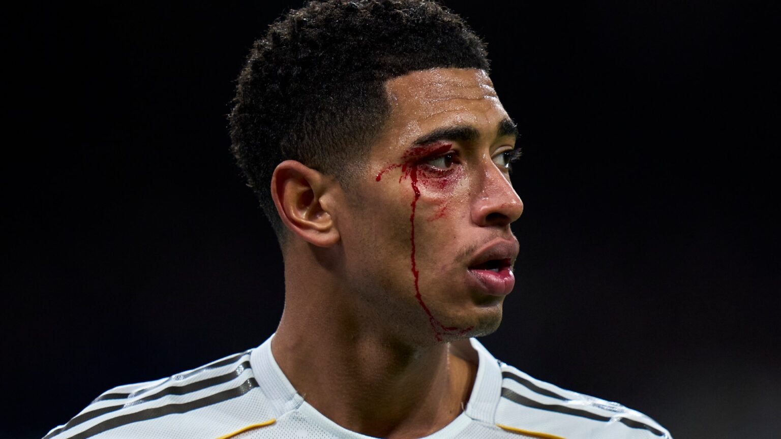 Jude Bellingham left with blood pouring down face after suffering nasty eye cut in Real Madrid’s clash vs Celta Vigo