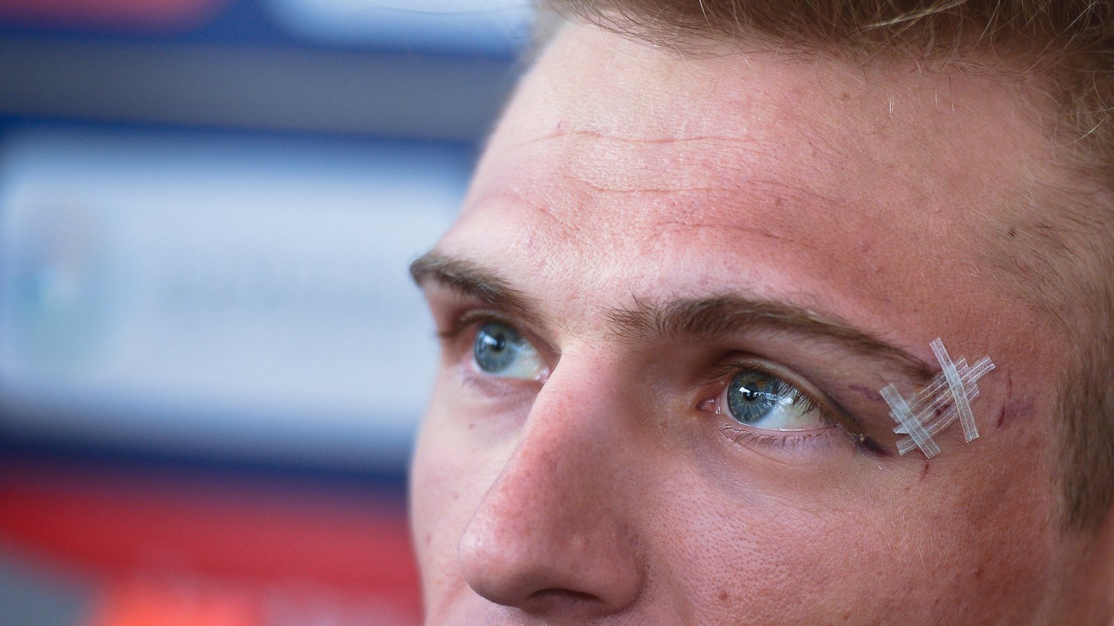 Marcel Kittel with his injured eye patched up during the 2017 Dubai Tour