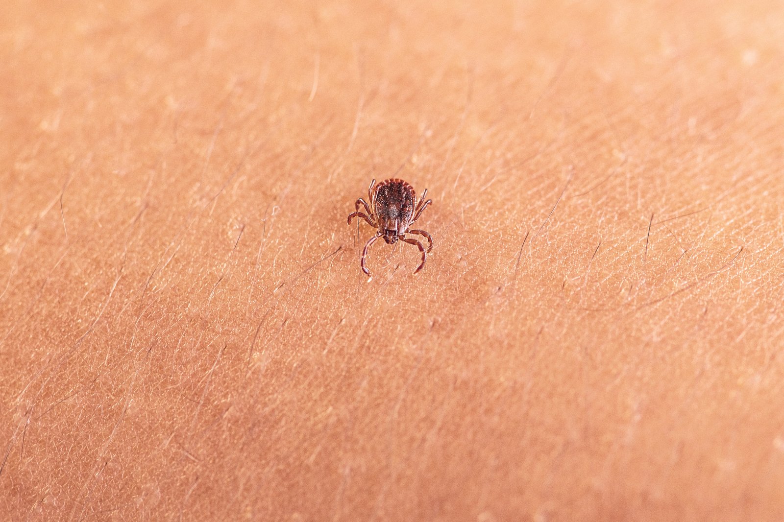 a tick on human skin