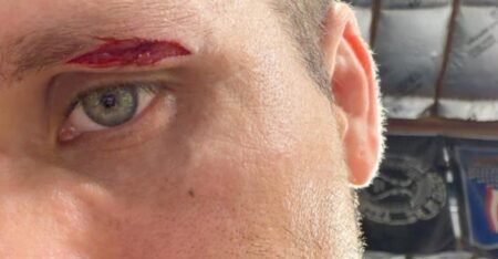 Brian Ortega shows cut that forced him out of UFC 331, teases new fight booked for November
